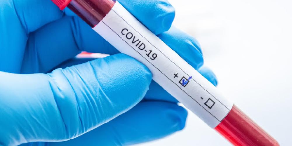 Another day of record COVID-19 infections reported as US approaches 10 million cases